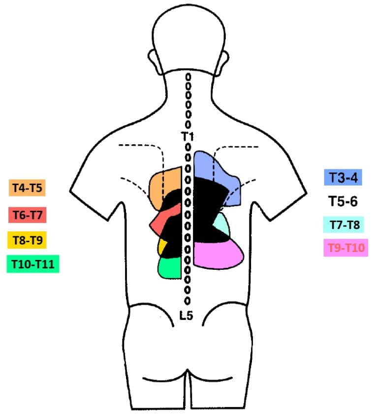 Middle Back Pain Red Flags